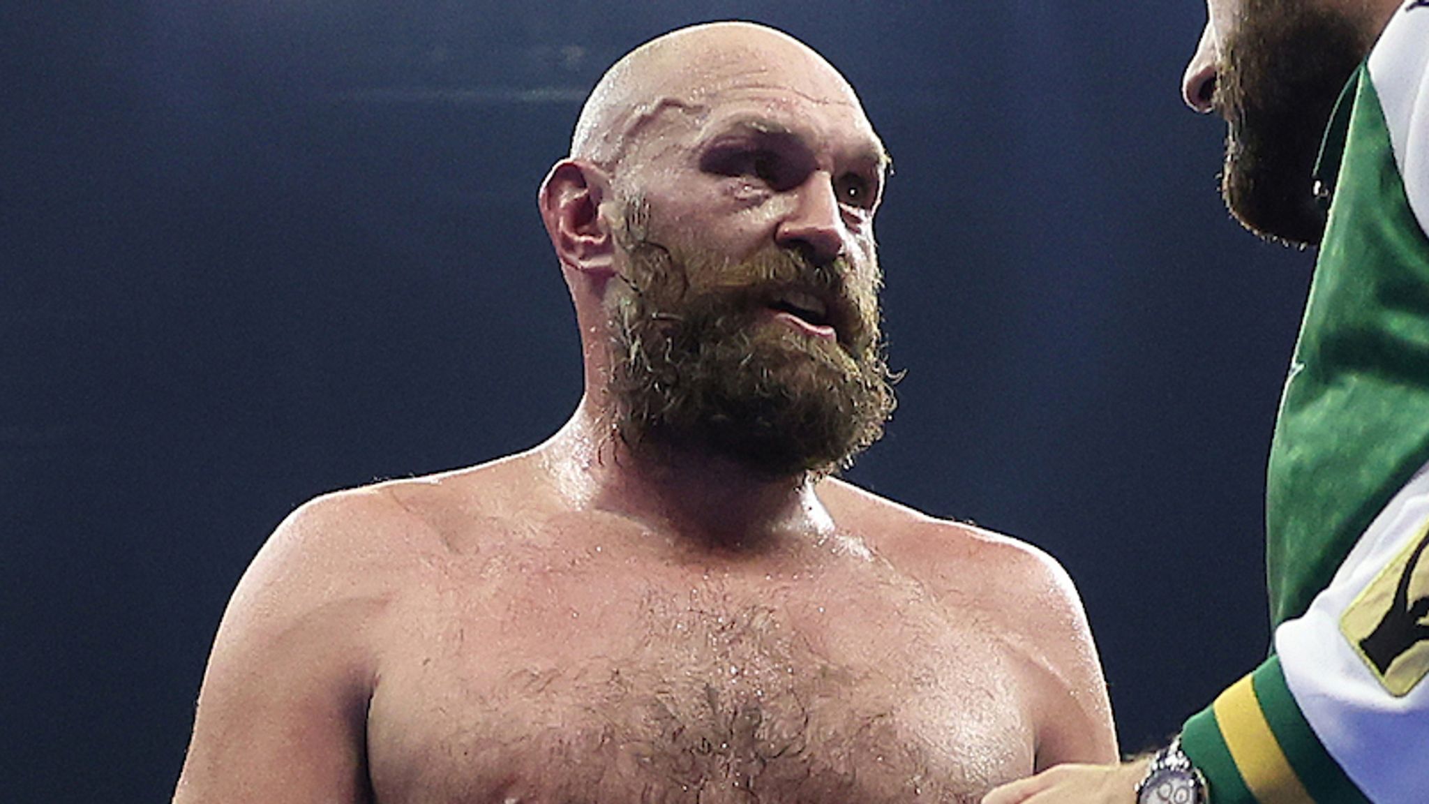 skysports-tyson-fury-oleksandr_6783005.jpg